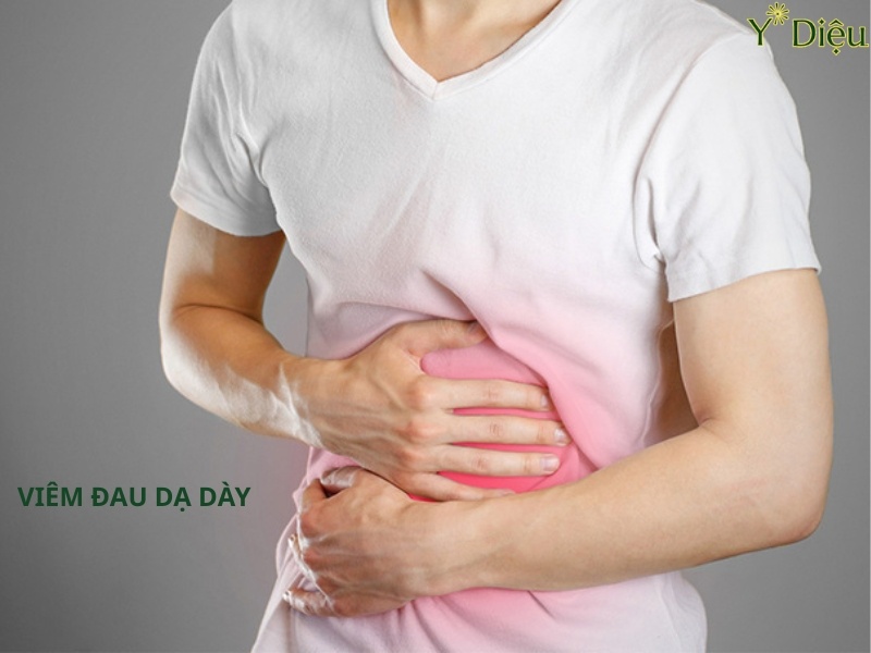 Viêm loét dạ dáy tá tràng gây đau vùng thượng vị